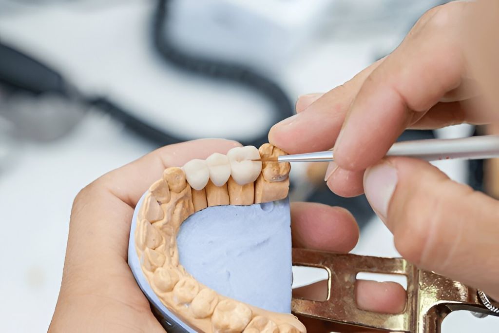 dental bridges near you
