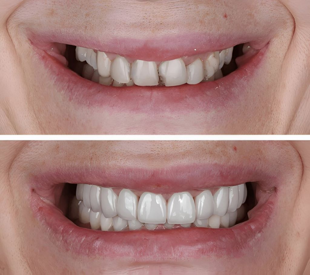 esthetic dentistry near you