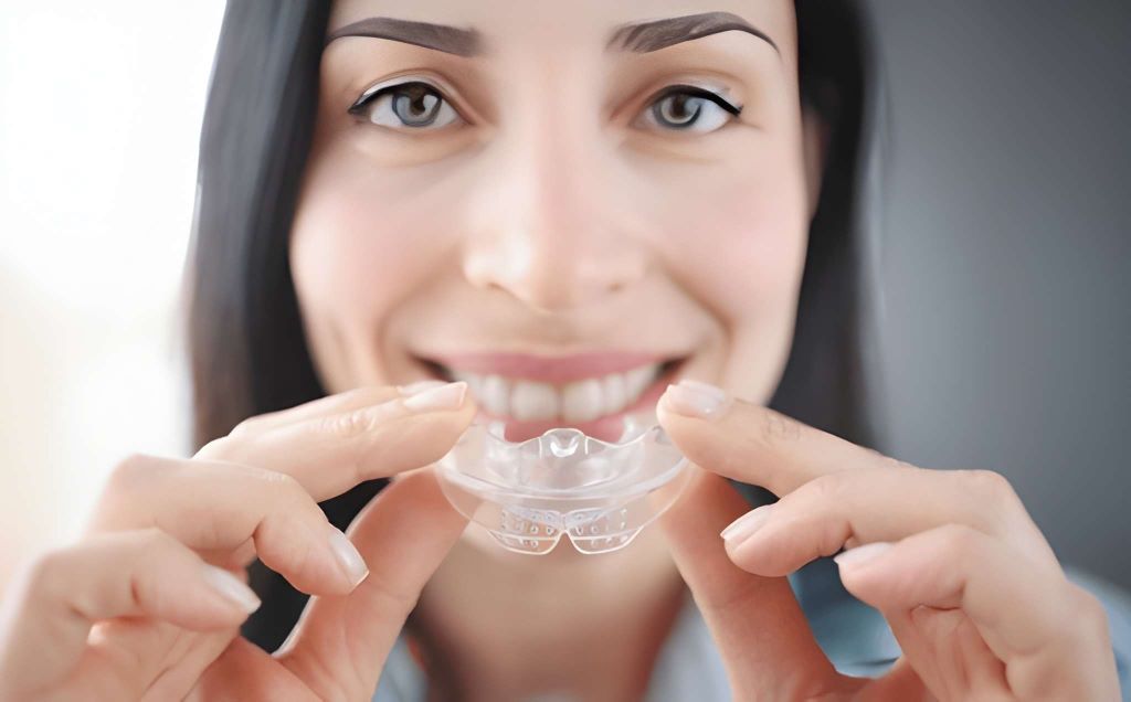 mouth guards in palm harbor, fl