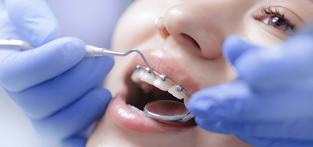 orthodontics in palm harbor, fl
