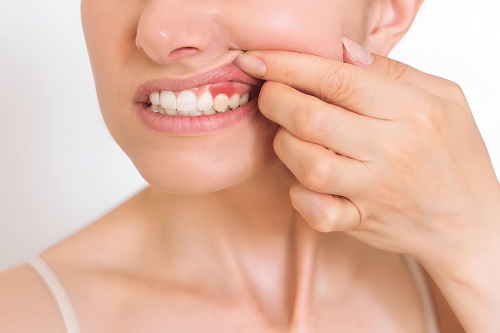 periodontal disease treatment in palm harbor, fl