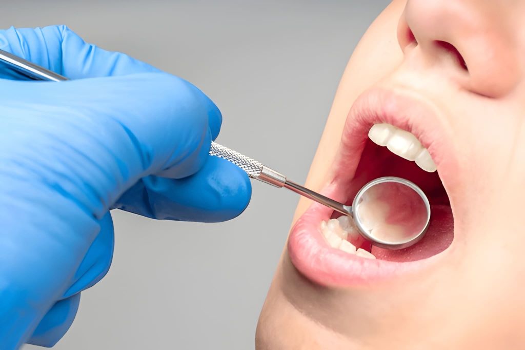 preventive dentistry in palm harbor, fl