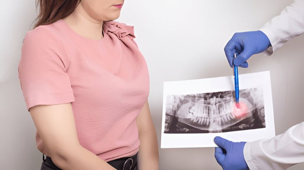 wisdom tooth extractions in palm harbor, fl