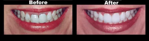 cosmetic dentistry smile transformation